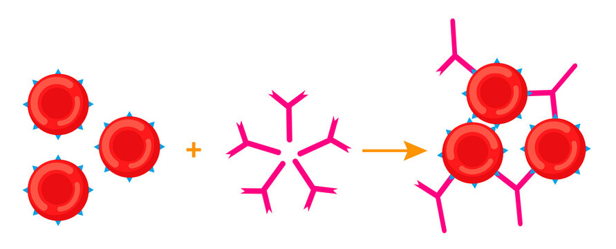Diagram of red blood cell agglutination mechanism by antibodies
