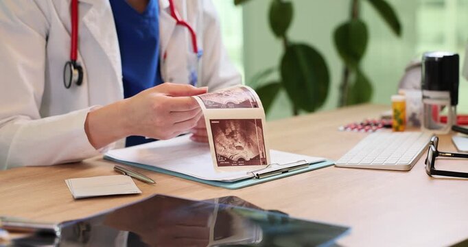 Woman doctor analyzes patient ultrasound images at office desk in clinic. Female healthcare professional holds inner organs scans in hospital