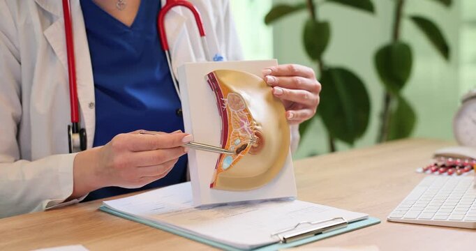 Woman doctor shows human breast anatomical model at desk. Female gynecologist warns about mammary gland cancer danger at appointment in hospital