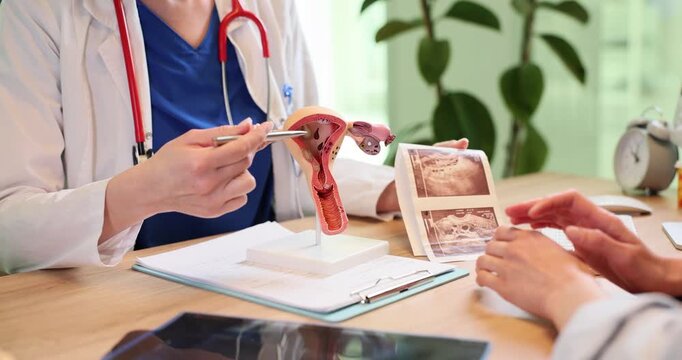 Female doctor consults woman as shows uterus model and ultrasound scans in clinic. Gynecologist explains treatment procedure to woman at appointment