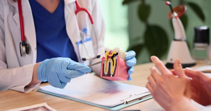 Female dentist shows tooth model with caries disease to patient in medical office. Doctor demonstrates damage spreading danger in stomatology clinic