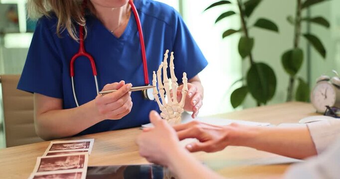 Female doctor shows hand bones on model to patient in clinic at appointment. Traumatologists explains danger of injury to woman in hospital office