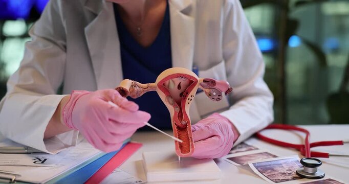 Gynecologist touches uterus anatomical model with swab in clinic office. Female doctor performs reproductive organs examination at appointment