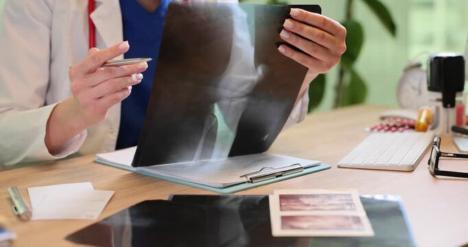 Female doctor observes x-ray image of patient knee joint in clinic office. Woman physician analyzes bones recovery process in hospital environment
