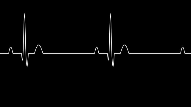 EKG heartbeat line animation transitioning to flatline on black.