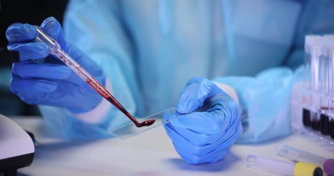 Medical specialist drips blood onto glass slide with pipette in lab. Assistant conducts tests of patient biological sample at healthcare facility