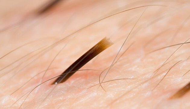 A lone hair rises like a dark mast on a pale skin sea, adrift in quiet unease