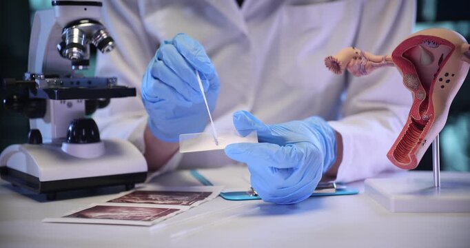 Doctor spreads vaginal smear on glass slide with swab in lab. Gynecologist conducts patient test with microscope near uterus model in clinic