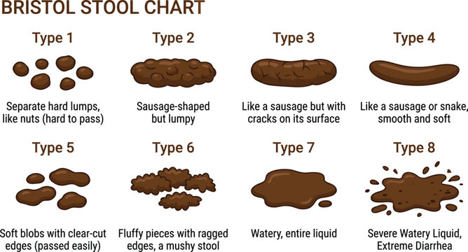 Bristol stool chart vector infographic showing medical poop types from constipation to diarrhea for health educational poster design