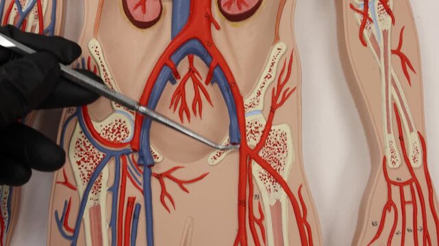 Following Femoral Artery Down Left Leg To Posterior Tibial