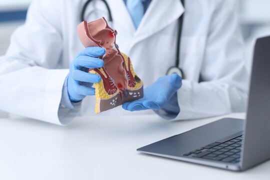 Doctor showing model of unhealthy lower rectum during online consultation at desk in clinic, closeup