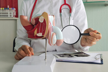 Fototapeta na wymiar Doctors counseling patients with prostate cancer and using a penis model to show patients with prostate cancer concept
