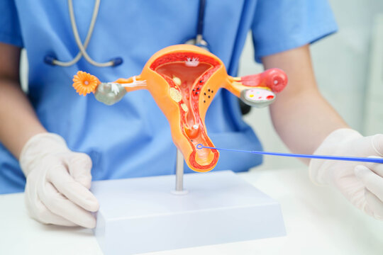 Doctor holding human uterus model for vaginal and cervix pap smear check up in the obstetrics and gynecology.