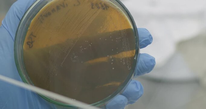 A scientist removes bacteria from a petri dish using a microbiological loop, close-up.