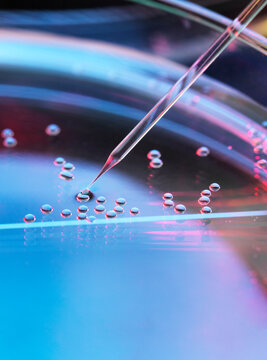 Stem cell research, nuclear transfer being carried out on several embryonic stem cells for cloning