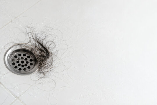 Excessive Hair Shedding Collected Near Shower Drain
