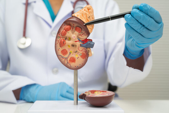 Chronic kidney disease, doctor with model for treatment urinary system, urology, Estimated glomerular filtration rate eGFR.