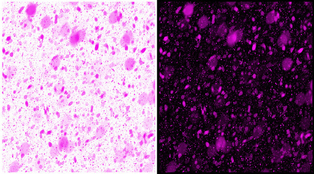 Microscopic purple cells on white and black background, biological tissue sample under microscope, scientific laboratory research histology slide