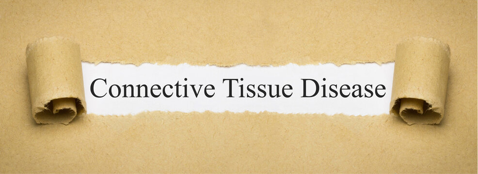 Connective Tissue Disease