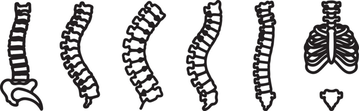 Different human spine curvature conditions illustration