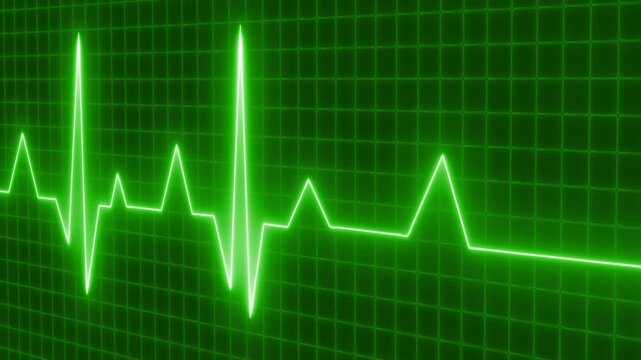 Glowing ecg heartbeat waveform on dark grid animation, Electrocardiogram waveform on dark grid background
