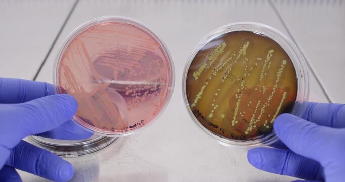 A scientist holds two Petri dishes with bacteria in both hands, comparing the results of an experiment on two Petri dishes in a laboratory.