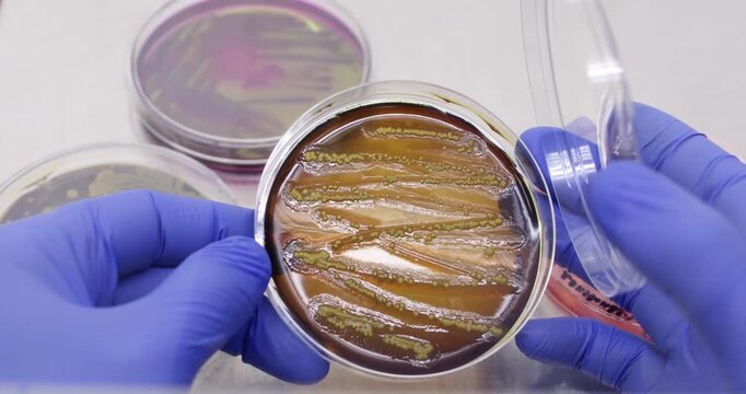 A scientist opens a petri dish in front of him and shows individual yellow colonies of bacteria on a nutrient medium, with petri dishes on a table in the background.