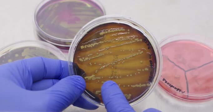 A scientist holds a petri dish with bacterial colonies in front of him, close-up.