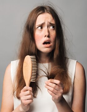 Shocked Young Woman Experiencing Excessive Hair Loss &ndash; Hair Fall, Damaged Hair, Alopecia, Haircare, Beauty, Scalp Health Concept