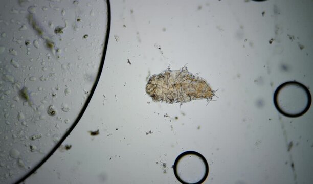 microorganisms, tardigrades under the microscope