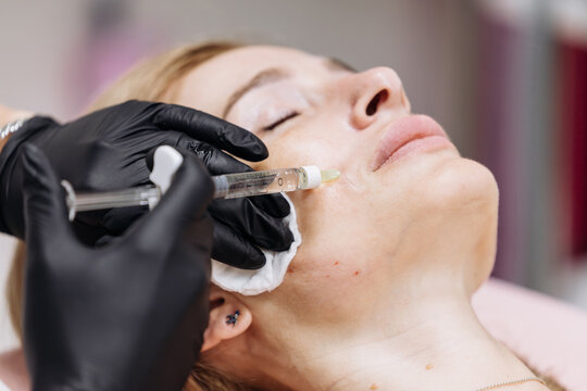 Cosmetic mesotherapy treatment for facial rejuvenation with syringe application in modern clinic. Concept anti-aging therapy, aesthetic care and skin health.
