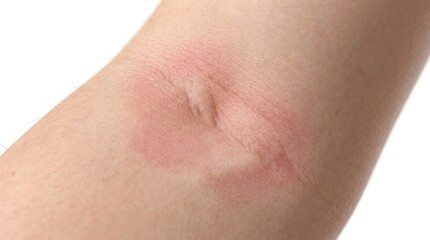 Fototapeta premium Firefly_Gemini Flash_Professional dermatology macro v 84380 tMr