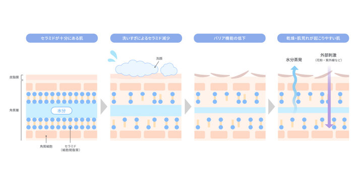 セラミド減少によるバリア機能低下と乾燥肌のメカニズムを解説するイラスト
