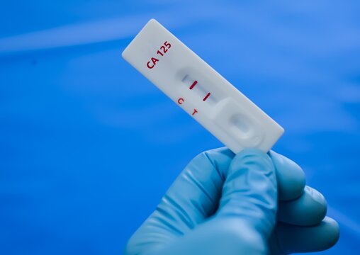 Blood sample of patient positive result for CA-125 