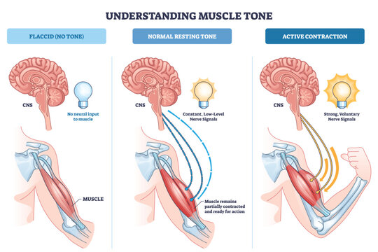 Muscle tone overview illustrates brain-CNS, nerve signals, and arm muscle across flaccid, resting, and active states, showing how neural input drives contraction. Outline diagram