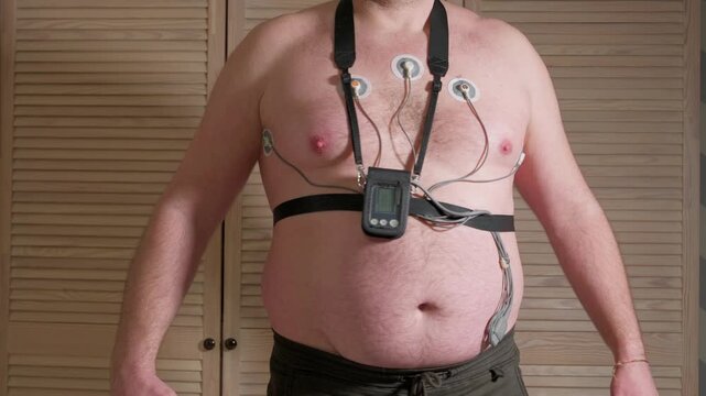 Middle-aged patient with a portable electrocardiogram device attached to his chest with electrodes, undergoing a 24-hour heart rhythm monitoring procedure for arrhythmia diagnostics