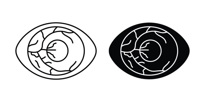 Reddened human eye close-up in line art and silhouette for medical or ophthalmology concepts
