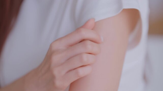Asian woman scratching her itchy arm suffering from skin allergy or dermatitis in living room at home, allergic reaction from atopic, insect bites. Healthcare and dermatology concept. health insurance