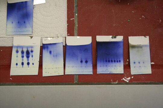 Thin Layer Chromatography (TLC) Plates in Chemistry Laboratory