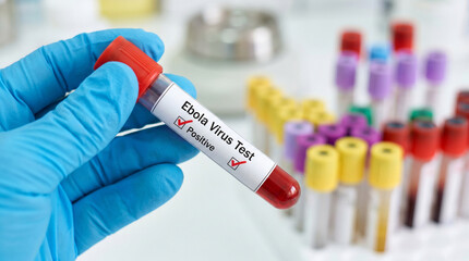 Fototapeta premium Scientist holding a clear glass test tube with a positive ebola virus diagnostic medical result