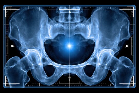 Anatomical X-ray of the human pelvis with a glowing blue center and digital grid overlay