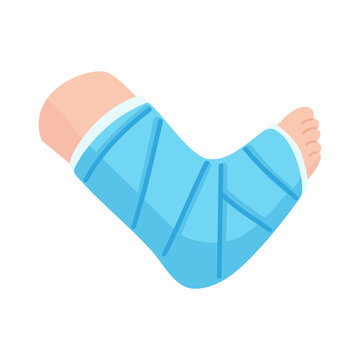 Cartoon illustration of a human leg and foot immobilized in a light blue cast, symbolizing injury and recovery