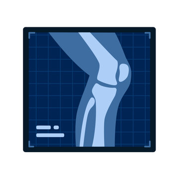 Medical X ray graphic of a leg and knee joint, vital for orthopedic diagnosis and education