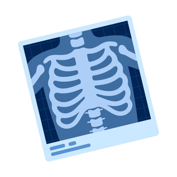 Illustrative X ray scan depicting the human rib cage and spine, essential for medical diagnostics.