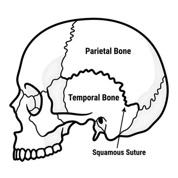 Human skull anatomy diagram with bone labels.