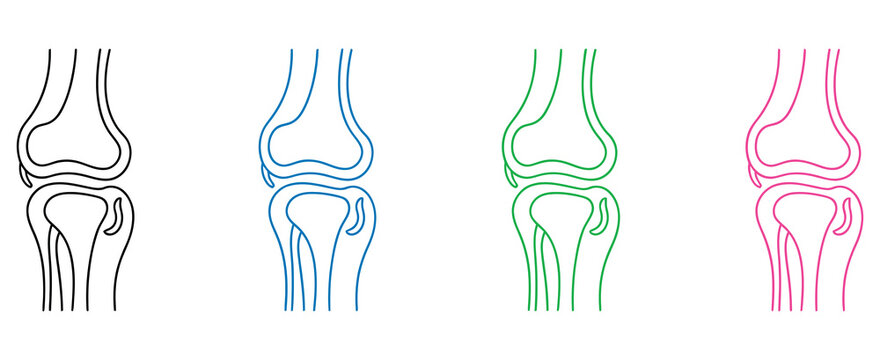 human knee joint bone and orthopedics medical icon set, rheumatology arthritis pain treatment, skeleton anatomy injury, physiotherapy healthcare symbol, detailed vector illustration collection.