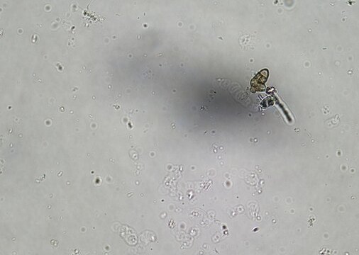 soil microorganisms under a microscope including amoeba, flagellates, nematodes, fungi, bacteria	