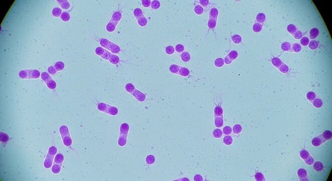 Purple diplococci bacteria under microscopic view.