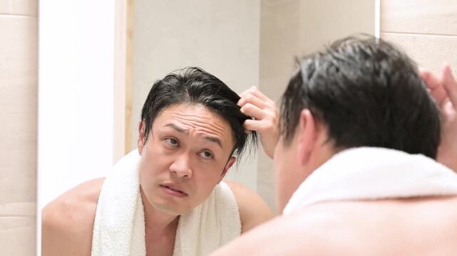 髪の生え際を気にする日本人男性