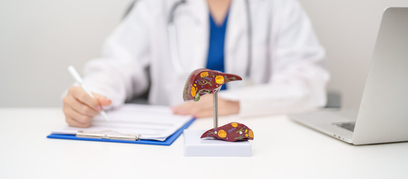 Doctor with human Liver anatomy model. Liver cancer and Tumor, Jaundice, Viral Hepatitis A, B, C, D, E, Cirrhosis, Failure, Enlarged, Hepatic Encephalopathy, Ascites Fluid in Belly and health concept